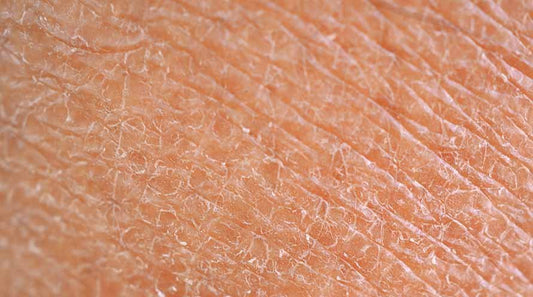 Козметични съставки за суха кожа, които помагат за предотвратяване на загубата на влага - Al+ Cosmetics