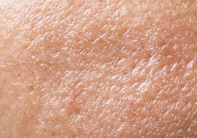 Мазна кожа: Какво трябва да знаете за този тип кожа? - Al+ Cosmetics