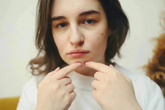 Най-честите грешки при стискането на пъпки + как да ги избегнем? - Al+ Cosmetics