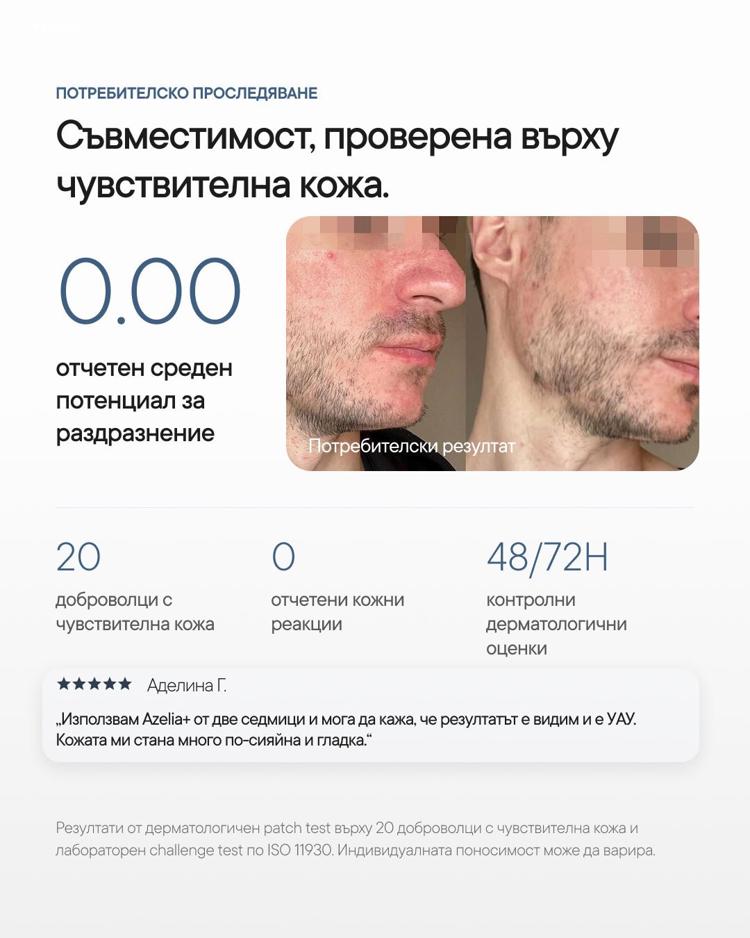 Azelia+ | Азелаинов серум за петна и пъпки - Al+ Cosmetics - 30 ML | Triple Azelaic Complex | AM/PM