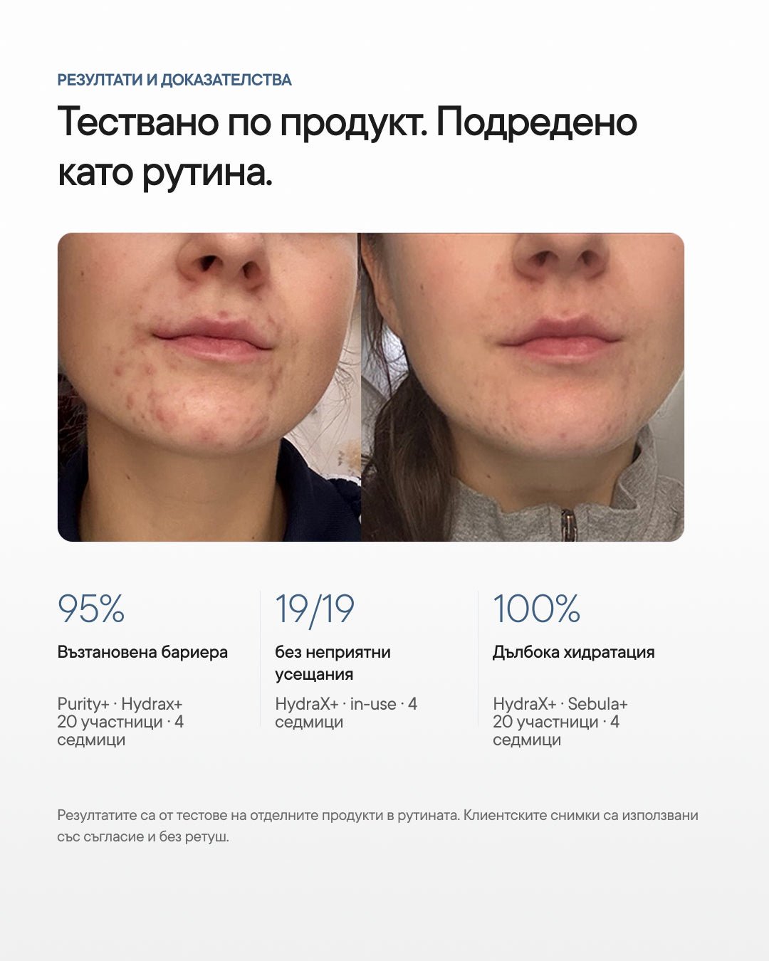 Barrier+ | Рутина за нарушена кожна бариера - Al+ Cosmetics - 3 продукта | Barrier support routine | 195 ML