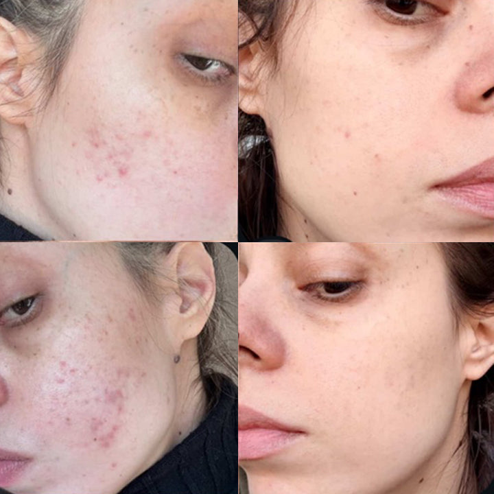 Redness Calm+ | Рутина за зачервяване и чувствителност