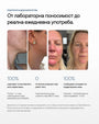 Clear Balance+ | Рутина за пъпки, омазняване и запушени пори - Al+ Cosmetics - 4 продукта | Clear skin AM/PM routine | 330 ML