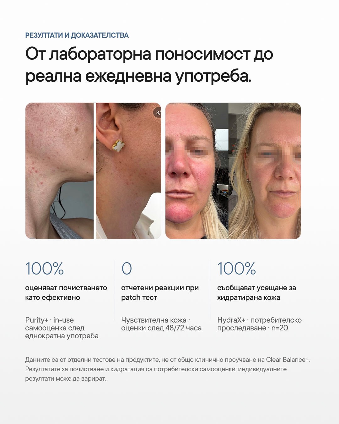 Clear Balance+ | Рутина за пъпки, омазняване и запушени пори - Al+ Cosmetics - 4 продукта | Clear skin AM/PM routine | 330 ML