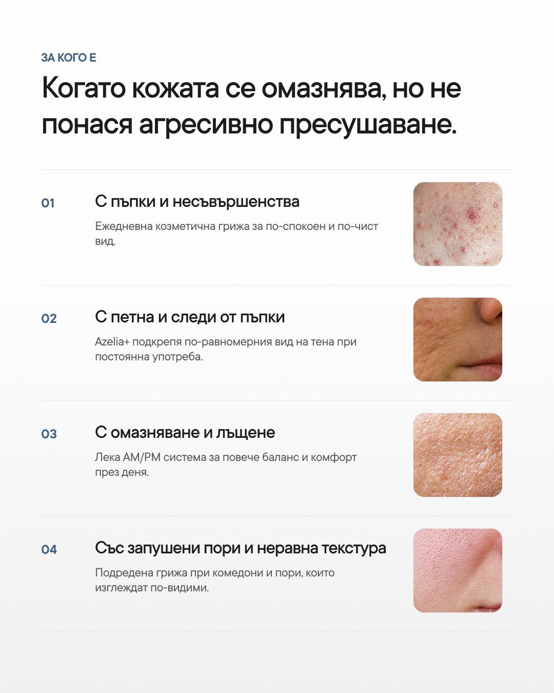 Clear Balance+ | Рутина за пъпки, омазняване и запушени пори - Al+ Cosmetics - 4 продукта | Clear skin AM/PM routine | 330 ML