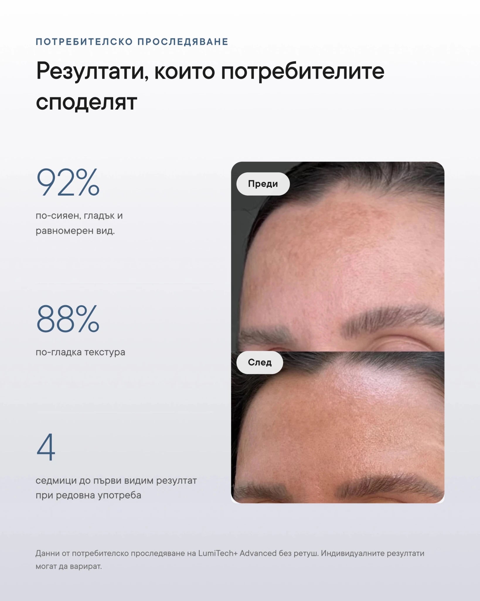 LumiTech+ Advanced LED Mask v2.0 - Al+ Cosmetics - LED маска за домашна грижа | 280-520 диода · 4 режима