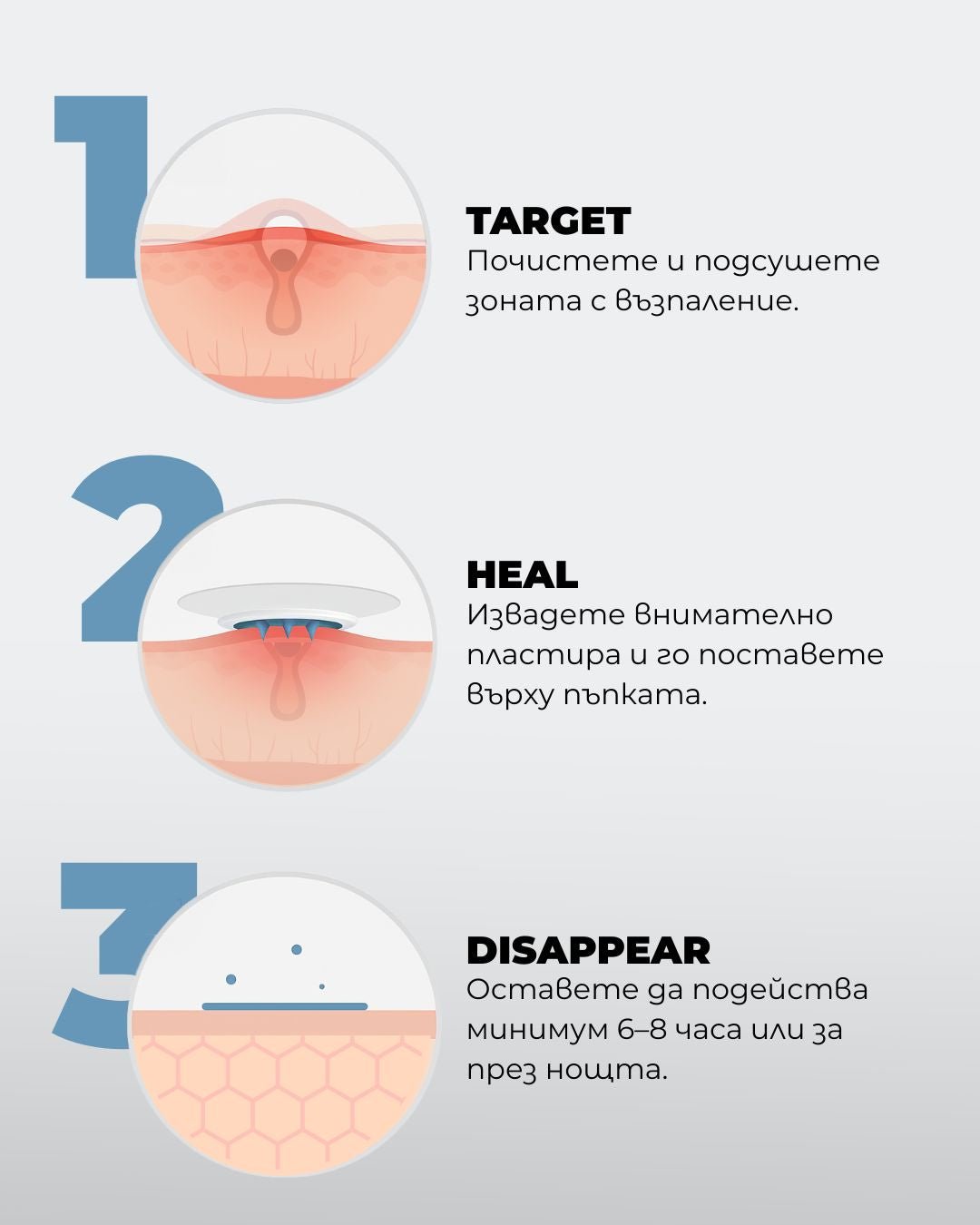 NeedleX+ Пластир с активни микроигли срещу пъпки - Al+ Cosmetics - 9 пластира за болезнени пъпки by Al+