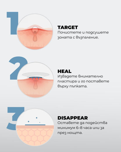 NeedleX+ Пластир с активни микроигли срещу пъпки - Al+ Cosmetics - 9 пластира за болезнени пъпки by Al+