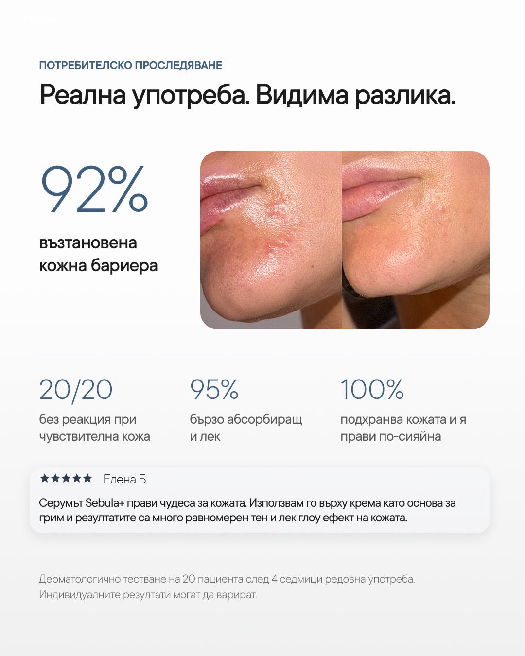 Sébula+ | Липиден серум със сквалан за чувствителна кожа - Al+ Cosmetics - 15 ML | 30% Squalane | Last step