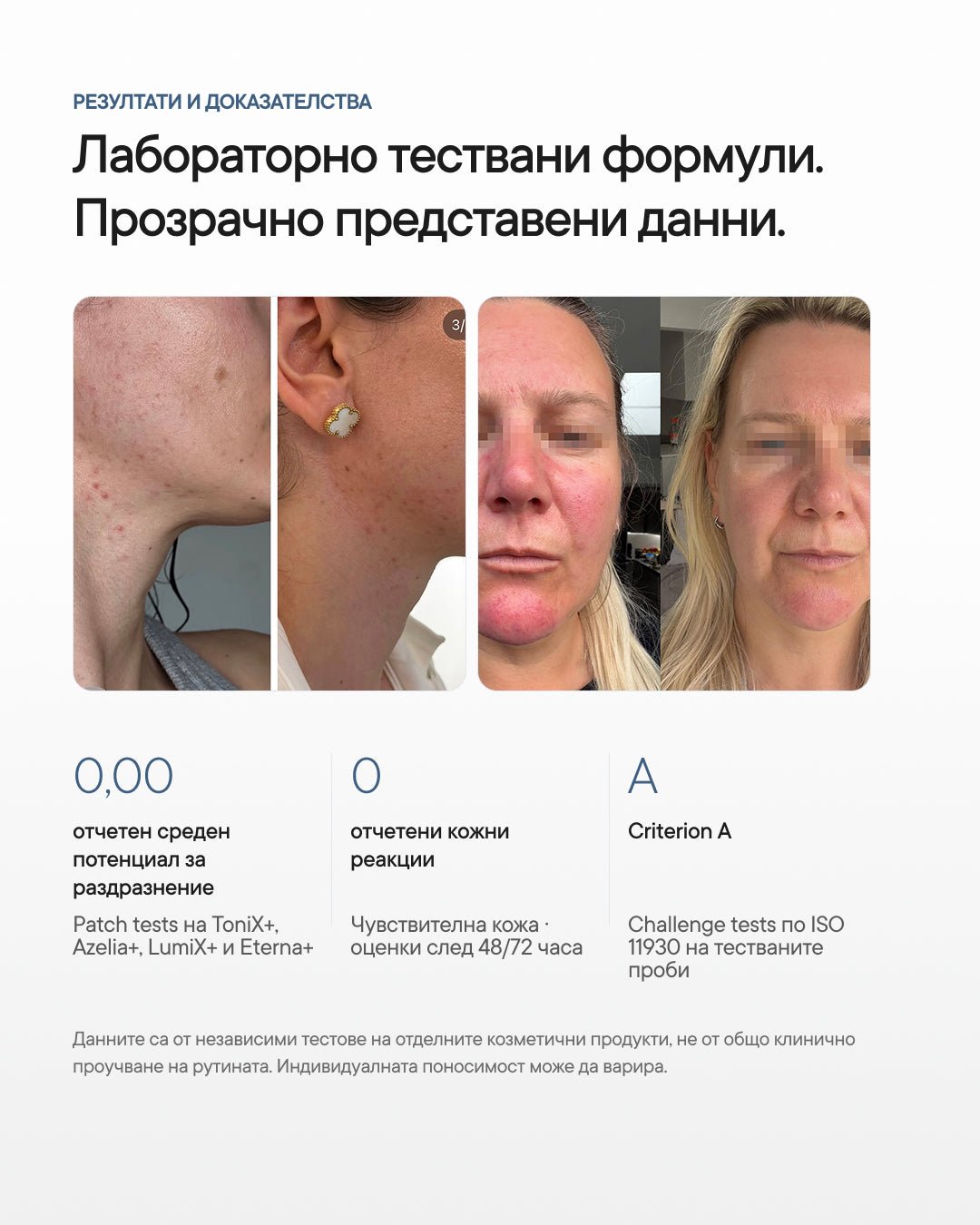 Skinstellar+ | Рутина за акне, петна и околоочна зона - Al+ Cosmetics - 4 продукта + ReGen+ patches | Skinstellar AM/PM routine | 180 ML